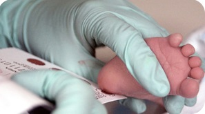 The blood of a two-week-old infant is collected for a Phenylketonuria screening